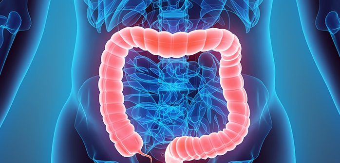 Articole/neoplasm-colon - ONCOFORT