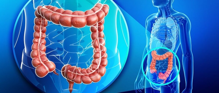 Articole/cancer-colon-oncofort