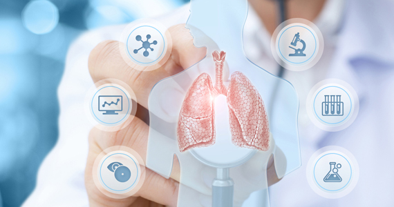 Articole/cancer bronhopulmonar Spitalul OncoFort